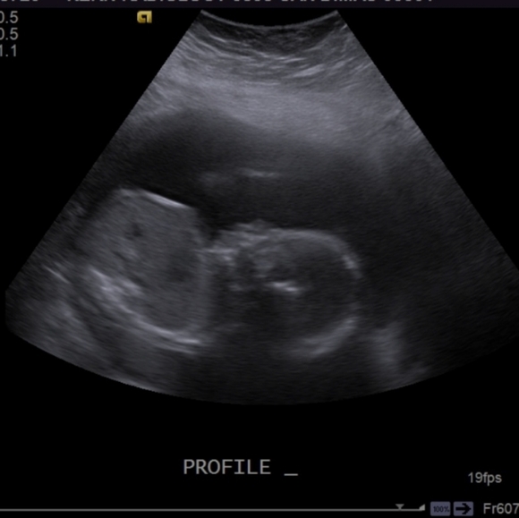 Diaper Fund Thank You Gift & Entry To Win Kate Spade Disney Beauty & the Beast - Picture 2 of 9